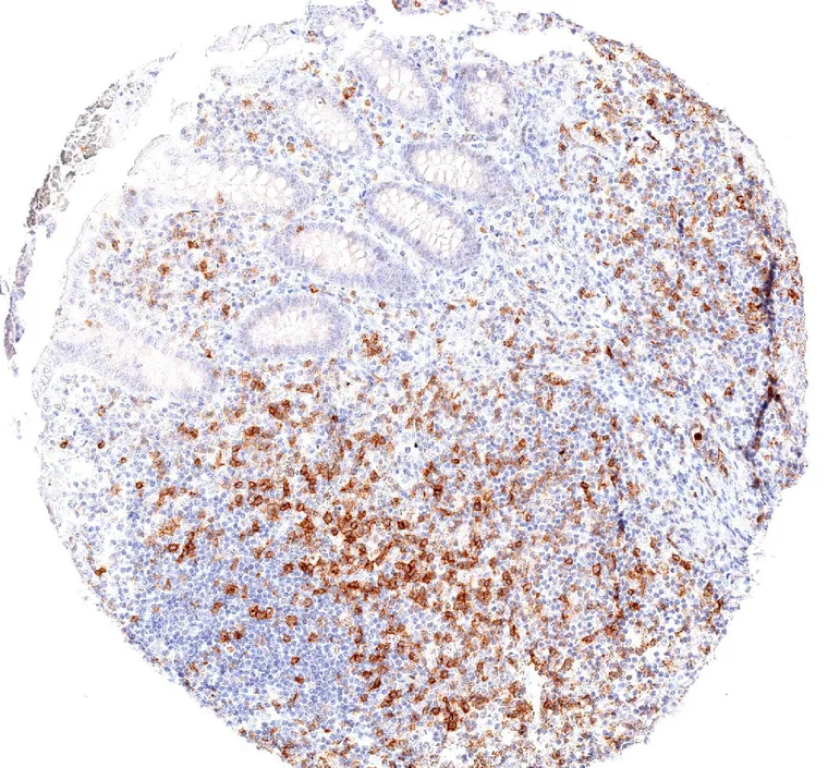 TIGIT positive lymphocytes are abundant in the mucosa of the appendix.