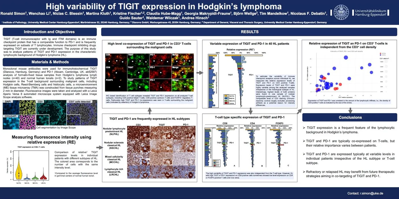 Kongressposter: High variability of TIGIT expression in Hodgkin’s lymphoma (AACR Annual Meeting 2018)