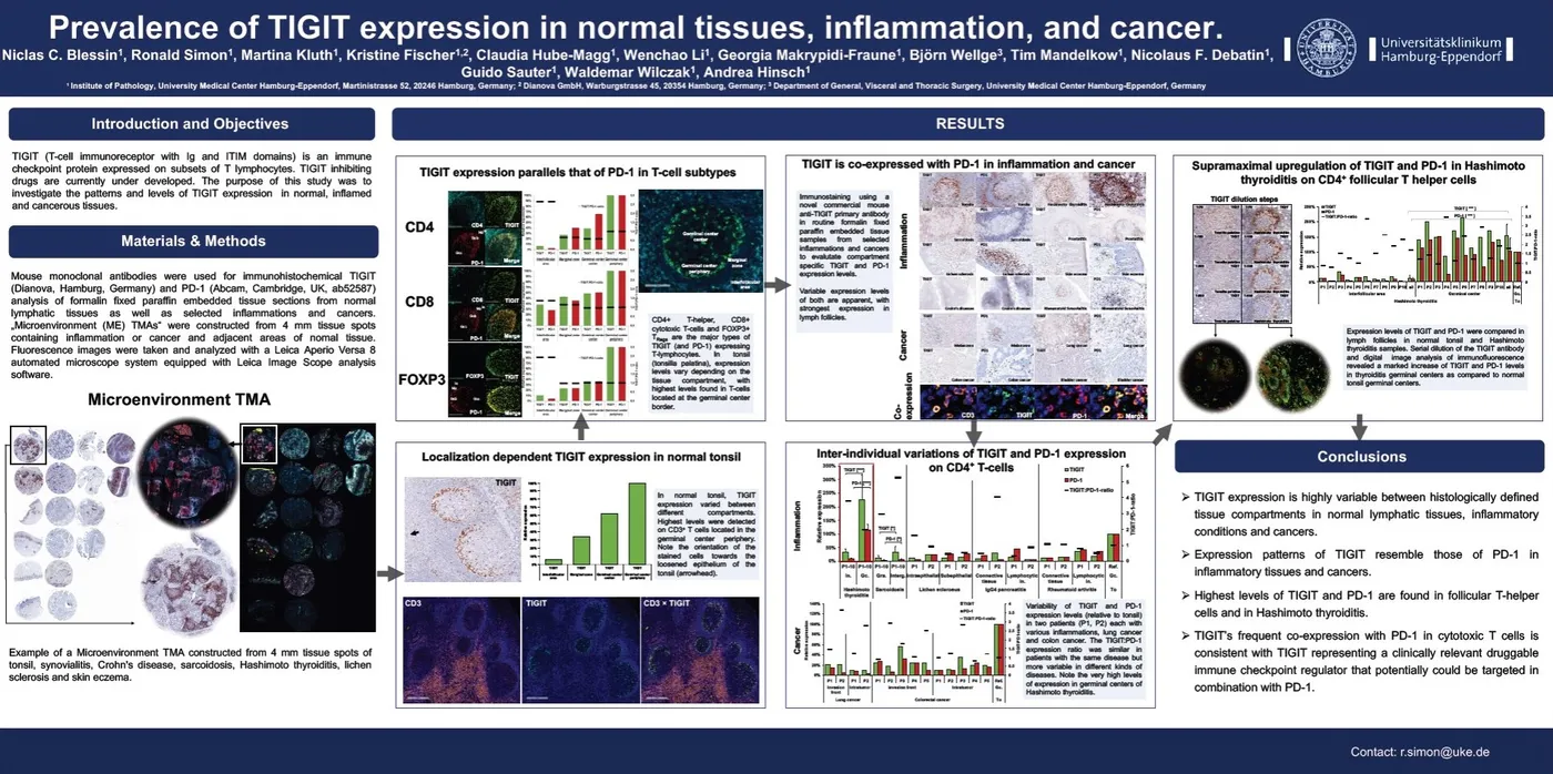 Kongressposter: Prevalence of TIGIT expression in normal tissues, inflammation, and cancer (AACR Annual Meeting 2018)