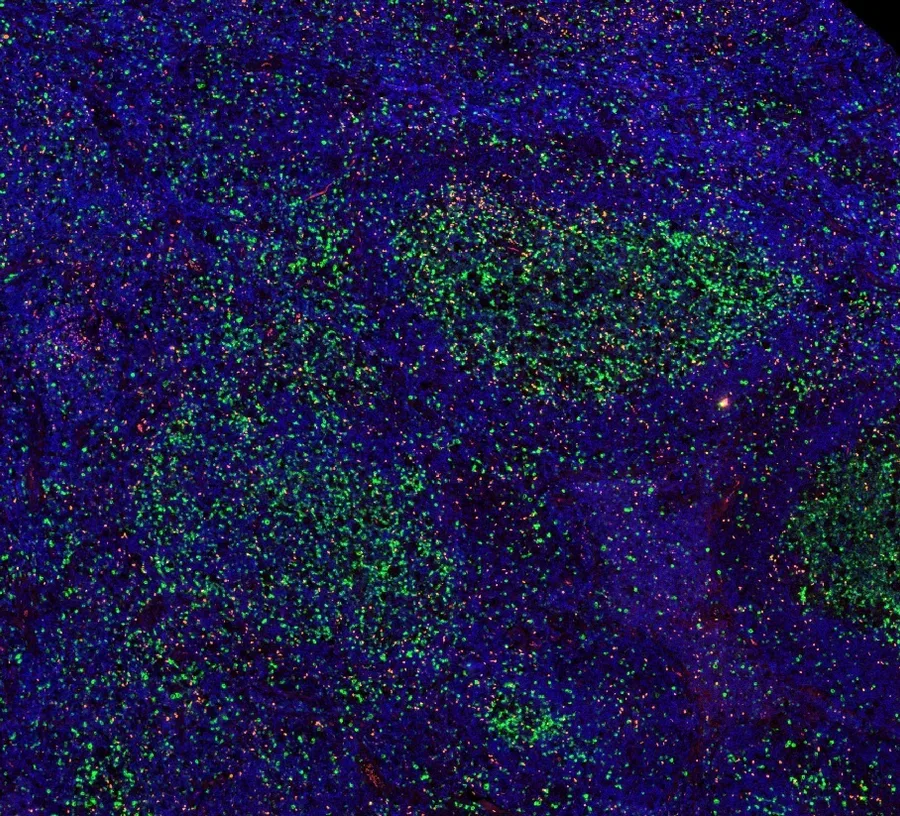 Multicolor immunofluorescence of FOXP3 (red; anti-FOXP3 clone FX3, DIA-FX3) and CD112R/PVRIG (green), magnification 4×, normal human tonsil – figure 01 of the ONCOdianova FOXP3 gallery.