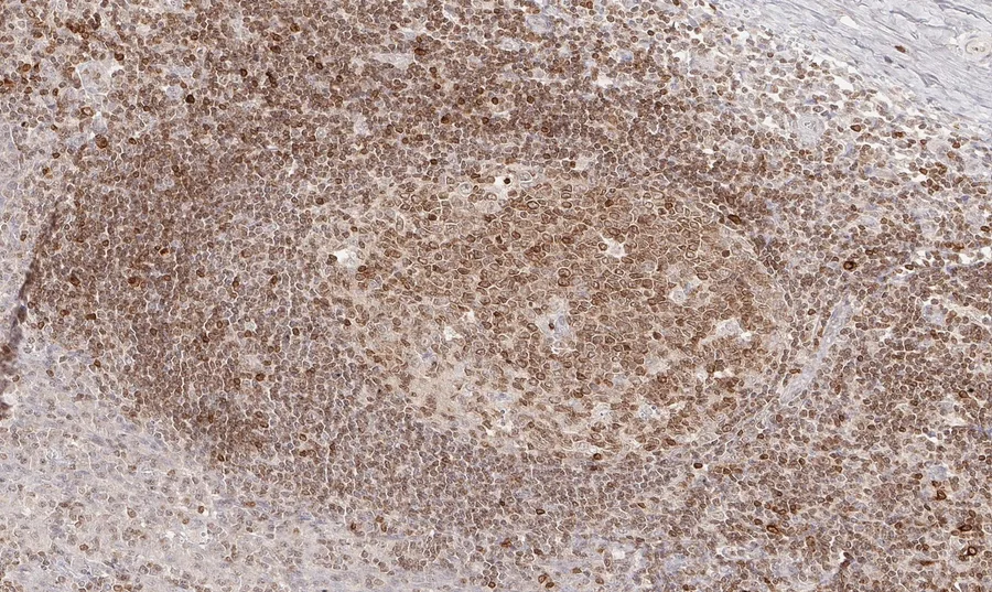 Immunhistochemischer Nachweis von humanem CD112R/PVRIG mit Anti-CD112R/PVRIG-Klon R12 (DIA-R12) in FFPE-Gewebe – Hellfeld-IHC, Abbildung 05 der ONCOdianova-CD112R-Galerie.
