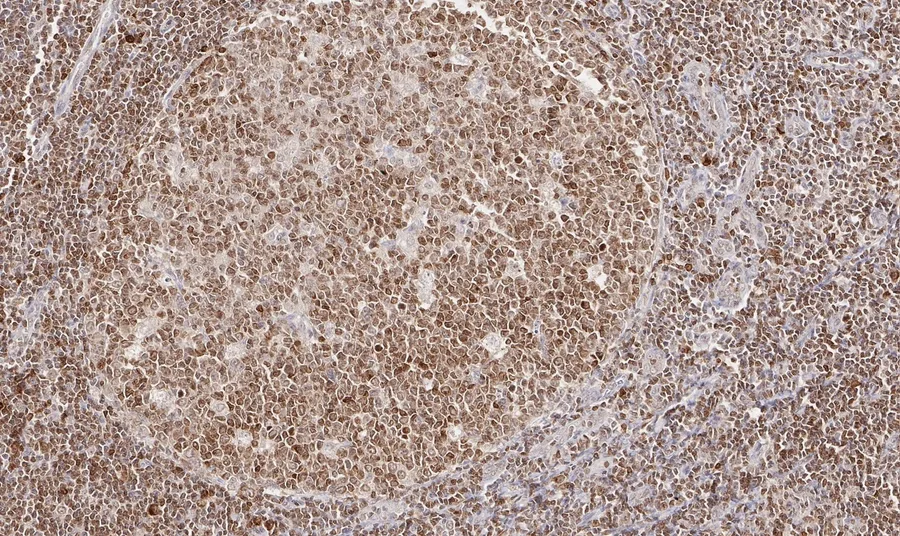 Immunhistochemischer Nachweis von humanem CD112R/PVRIG mit Anti-CD112R/PVRIG-Klon R12 (DIA-R12) in FFPE-Gewebe – Hellfeld-IHC, Abbildung 06 der ONCOdianova-CD112R-Galerie.