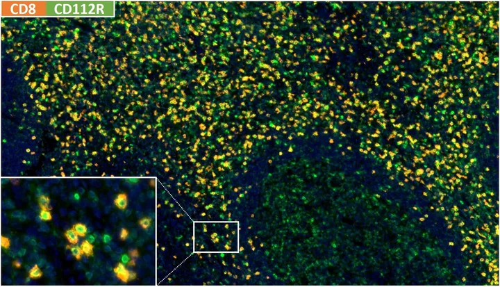 Fluoreszenz-Multiplex-Immunhistochemie einer normalen humanen Tonsille mit Anti-CD8 (DIA-TC8; orange/rot) und Anti-CD112R/PVRIG-Klon R12 (DIA-R12; grün), Zellkerne blau – Abbildung 01 der bisherigen ONCOdianova-CD112R-Galerie.
