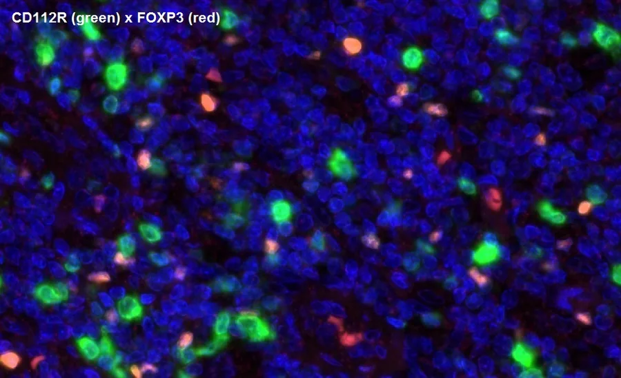 Mehrfarben-Immunfluoreszenz von CD112R/PVRIG (grün; Klon R12) und FOXP3 (rot), Vergrößerung 40×, normale humane Tonsille – Abbildung 15 der ONCOdianova-CD112R-Galerie.