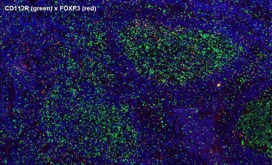 Mehrfarben-Immunfluoreszenz von CD112R/PVRIG (grün; Klon R12) und FOXP3 (rot), Vergrößerung 4×, normale humane Tonsille – Abbildung 14 der ONCOdianova-CD112R-Galerie.