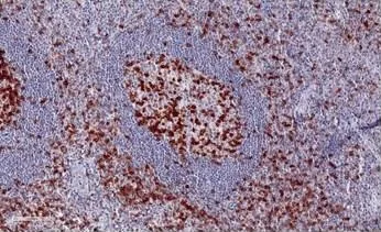 Normal human tonsil with numerous TIGIT-positive lymphocytes (ONCOdianova reference image, datasheet V17, Fig. A).