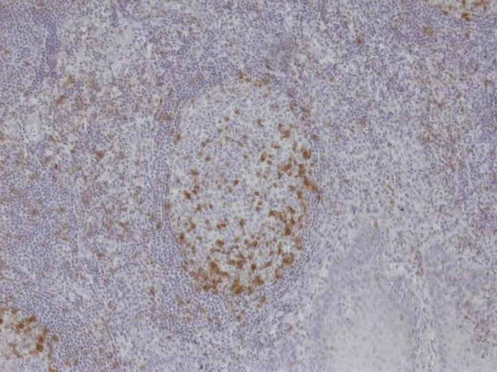 TG-1-Immunfärbung an humaner Tonsille bei 100× (ONCOdianova-Referenzabbildung, Tech Note V1, Abb. 1).
