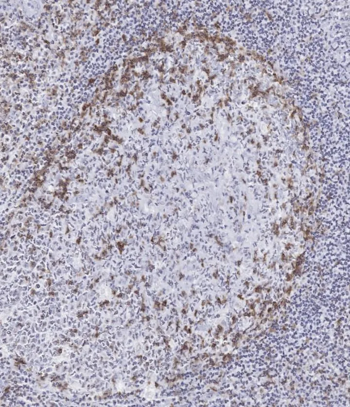 Immunhistochemischer Nachweis von humanem TIGIT in FFPE-Tonsille mit Klon TG2 – normale humane Tonsille mit zahlreichen TIGIT-positiven Lymphozyten (ONCOdianova-Referenzabbildung, Datenblatt DIA-TG2-M V05).