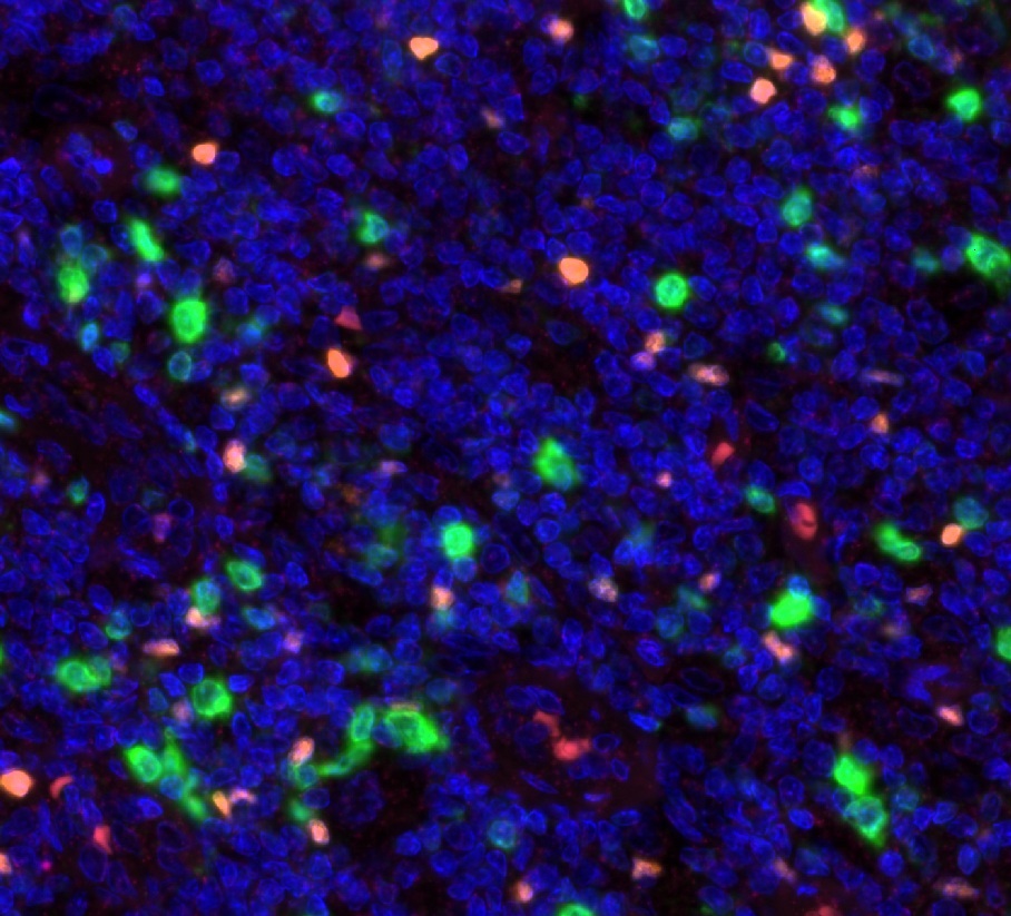 Mehrfarben-Immunfluoreszenz von FOXP3 (rot; Anti-FOXP3-Klon FX3, DIA-FX3) und CD112R/PVRIG (grün; Anti-CD112R-Klon R12, DIA-R12), Vergrößerung 40×, normale humane Tonsille
