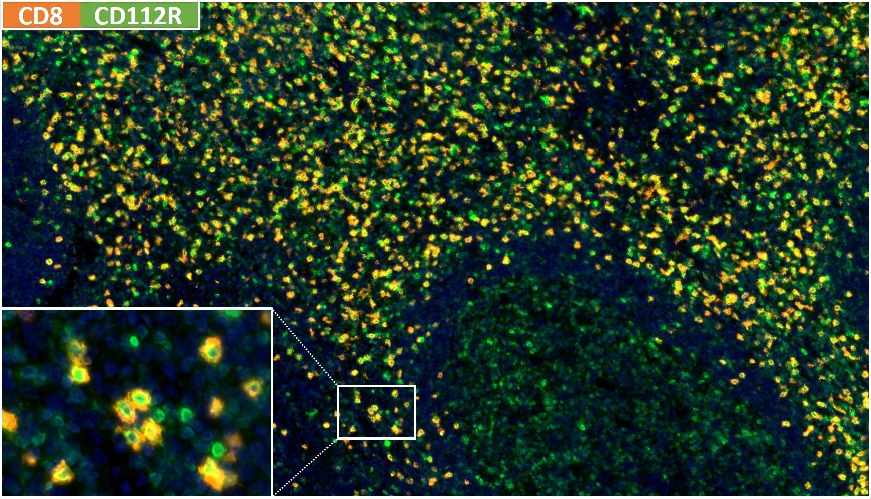 Produktabbildung des ONCOdianova-Anti-CD112R/PVRIG-Antikörpers Klon R12: Fluoreszenz-Multiplex-Immunhistochemie einer normalen humanen Tonsille mit Anti-CD8 (DIA-TC8) und Anti-CD112R/PVRIG-Klon R12 (DIA-R12)
