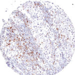 TIGIT antibody