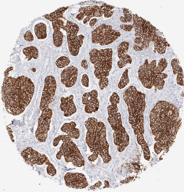 CD138/Syndecan-1 antibody