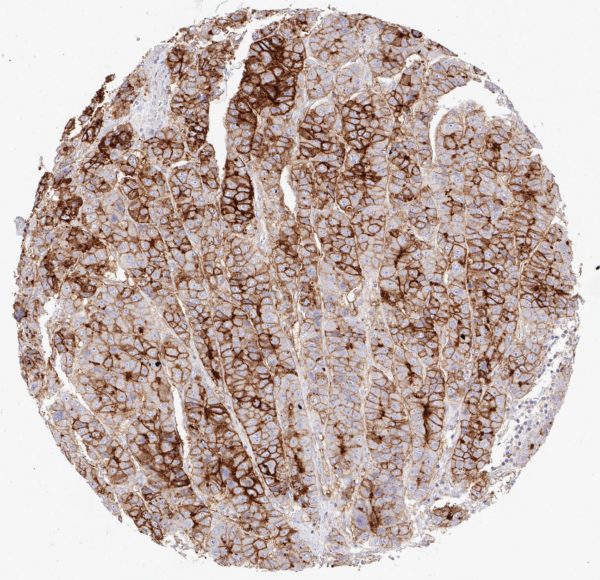 CD73 antibody