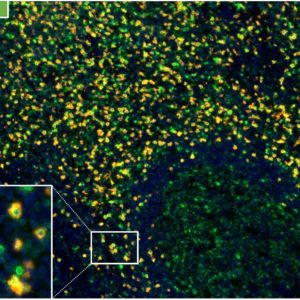 Fig.01-CD112RxCD8-multiplex-IHC